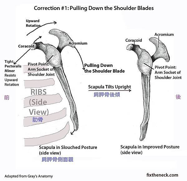 posterior tilt