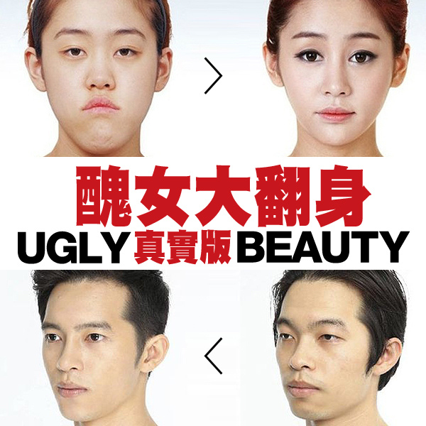 醜女大翻身_金雅中_漢娜_整型_胡白說 醜女大翻身_金雅中_漢娜_整型_胡白說