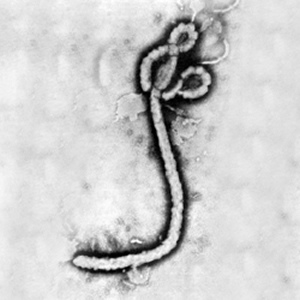 Ebola_virus_1 Ebola_virus_1