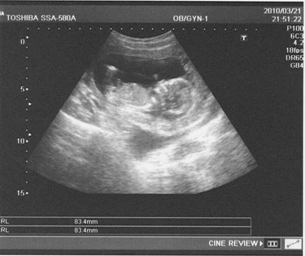 Baby Coco0321.Jpg