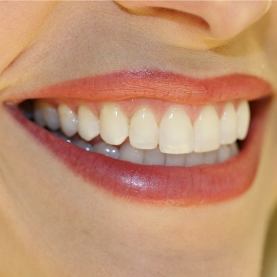 口紅成分若含重金屬　嚴重易導致皮膚潰爛