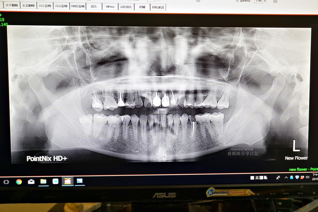 免费谘询还提供口腔检测的贴心服务~  我做完全口检测x光片原图  宋