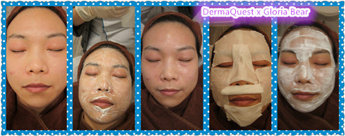 DermaQuest 04