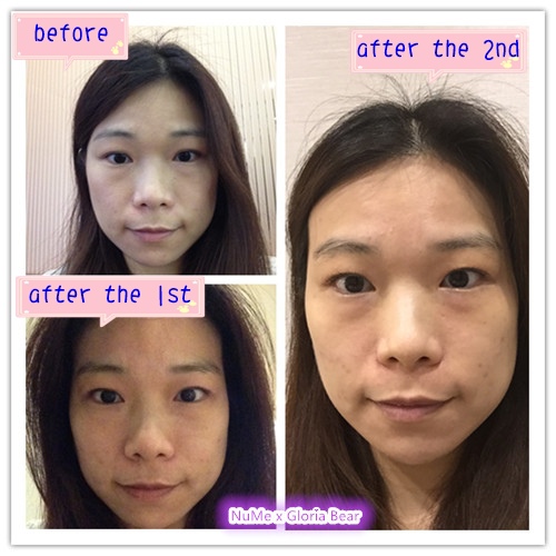 NuMe 22.jpg NuMe 22.jpg