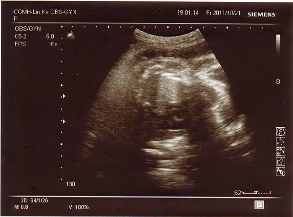 1021-2.jpg 1021-2.jpg