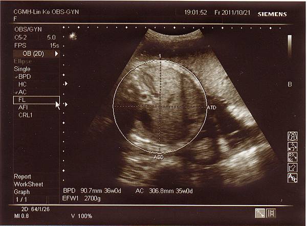 1021-5.jpg 1021-5.jpg