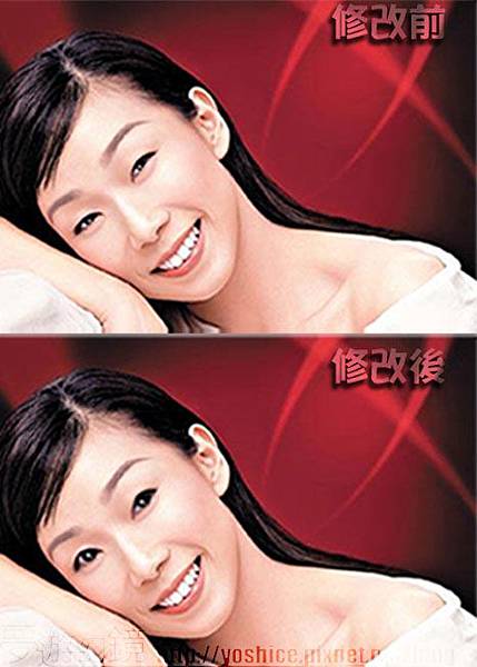 五官液化整型比較檔.jpg 五官液化整型比較檔.jpg