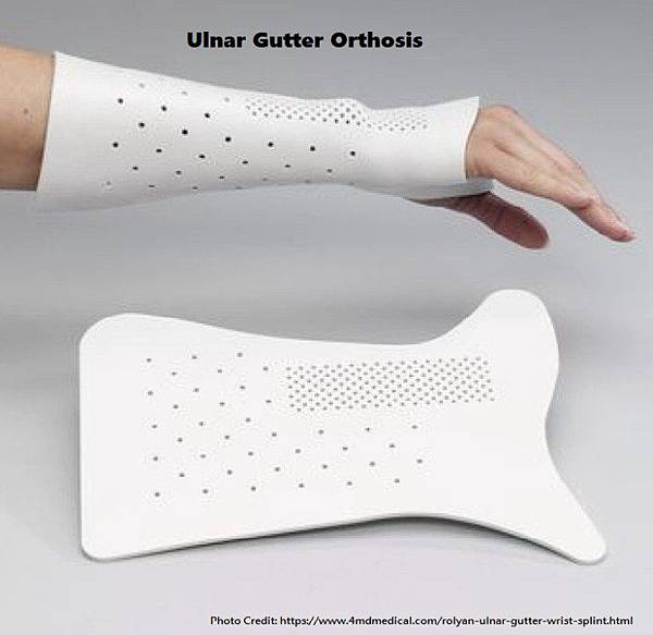 xrolyan-ulnar-gutter-wrist-splint-6da.jpg.pagespeed.ic_.vnLmp4Go6b.jpg xrolyan-ulnar-gutter-wrist-splint-6da.jpg.pagespeed.ic_.vnLmp4Go6b.jpg