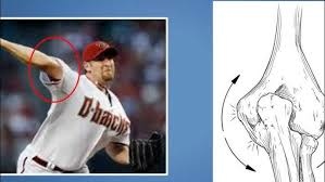 棒球選手尺側副韌帶重建術後的臨床結果