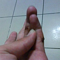 thumb