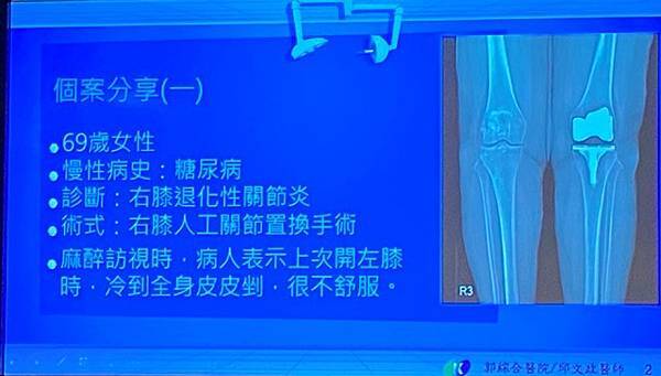 開刀毋免冷吱吱手術全期病人體溫管理