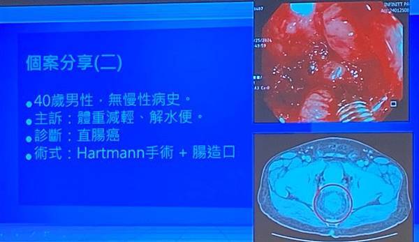 開刀毋免冷吱吱手術全期病人體溫管理