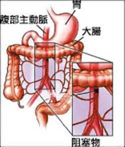 愛