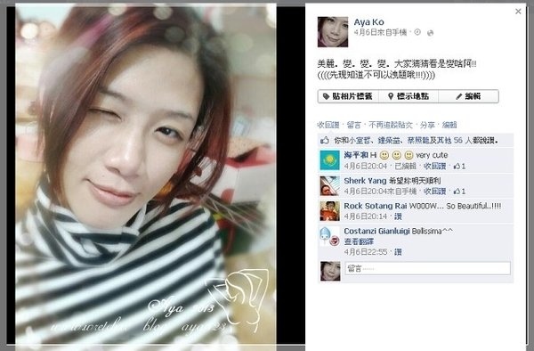 AYA絨毛果凍隆胸手術