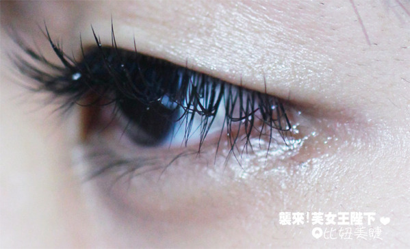 芙兒割雙眼皮手術