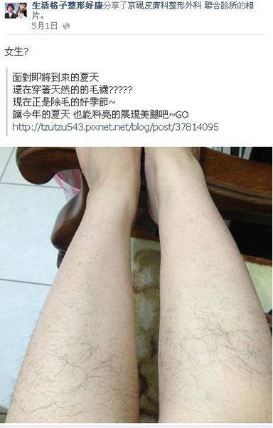 滋滋-德國光纖除毛3