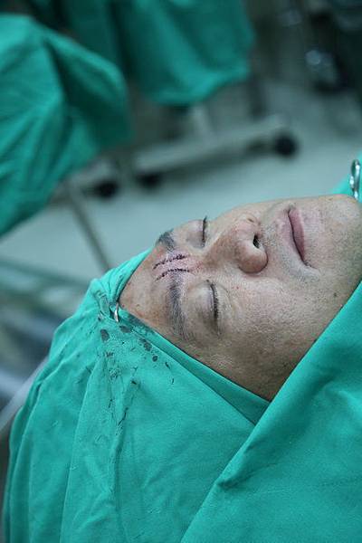 貓大爺-皺眉紋 (17) 貓大爺-皺眉紋 (17)