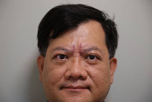 貓大爺-皺眉紋 (20) 貓大爺-皺眉紋 (20)