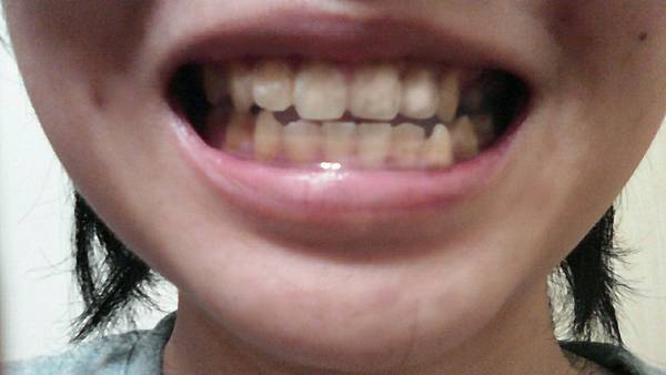 2015-07-31-22-08-23_deco.jpg 試用