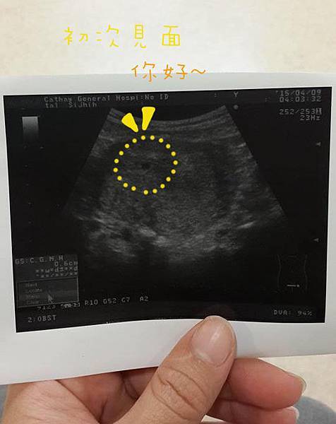 11134256_10203942384415421_1934789508_n拷貝 11134256_10203942384415421_1934789508_n拷貝