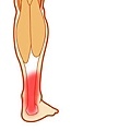 小腿肌肉痠痛.jpg