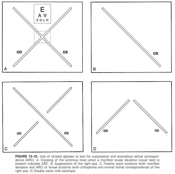 13-15 striated glasses test