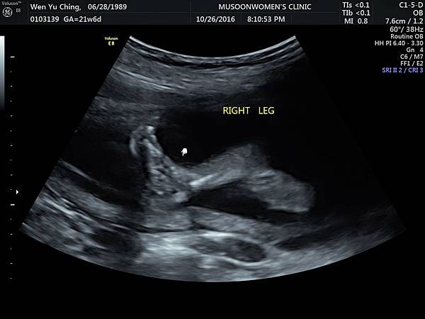 0103139_溫郁清_20161026__50