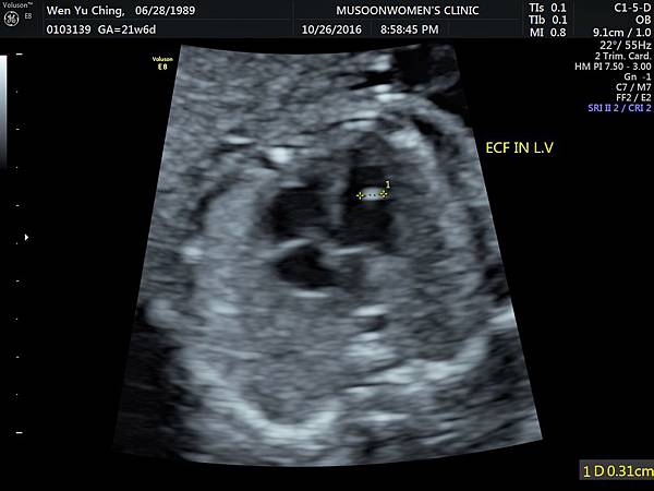 0103139_溫郁清_20161026__74