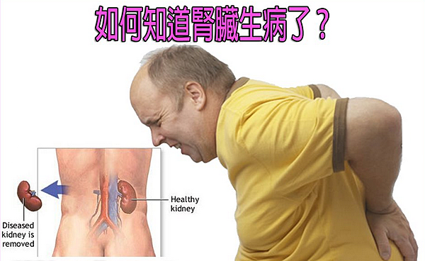 如何知道腎臟生病了 如何知道腎臟生病了