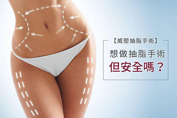抽脂手術局部雕塑抽脂手術風險抽脂手術費用抽脂會痛嗎抽脂手術後遺症抽脂ptt抽脂手術過程抽脂復胖抽脂台北抽脂失敗抽脂安全威塑抽脂價錢01.jpg 抽脂手術局部雕塑抽脂手術風險抽脂手術費用抽脂會痛嗎抽脂手術後遺症抽脂ptt抽脂手術過程抽脂復胖抽脂台北抽脂失敗抽脂安全威塑抽脂價錢01.jpg