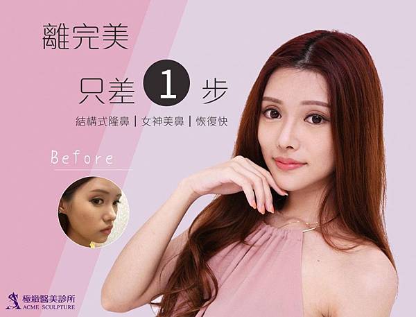 隆鼻手術韓式隆鼻隆鼻多少錢台北極緻隆鼻台灣隆鼻費用隆鼻幾多錢極緻隆鼻ptt推薦隆鼻失敗二次隆鼻重重新隆鼻玻尿酸隆鼻埋線隆鼻 (4) 隆鼻手術韓式隆鼻隆鼻多少錢台北極緻隆鼻台灣隆鼻費用隆鼻幾多錢極緻隆鼻ptt推薦隆鼻失敗二次隆鼻重重新隆鼻玻尿酸隆鼻埋線隆鼻 (4)