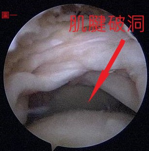 圖一  rct.jpg 圖一  rct.jpg