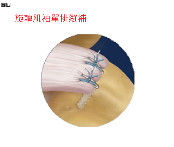 單排.png 單排.png