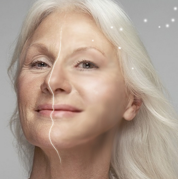 台北音波拉皮 台北音波拉皮