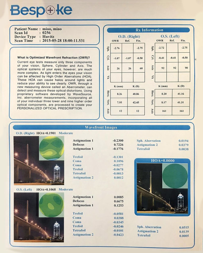 為眼睛量身打造!瑞光生眼適能光學 Besp⊕ke 前導波鏡片 + TENXION 鈦金屬鏡框 @3C 達人廖阿輝 為眼睛量身打造!瑞光生眼適能光學 Besp⊕ke 前導波鏡片 + TENXION 鈦金屬鏡框
