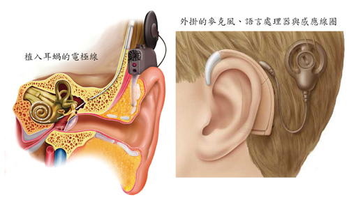 電子耳的卡通圖像
