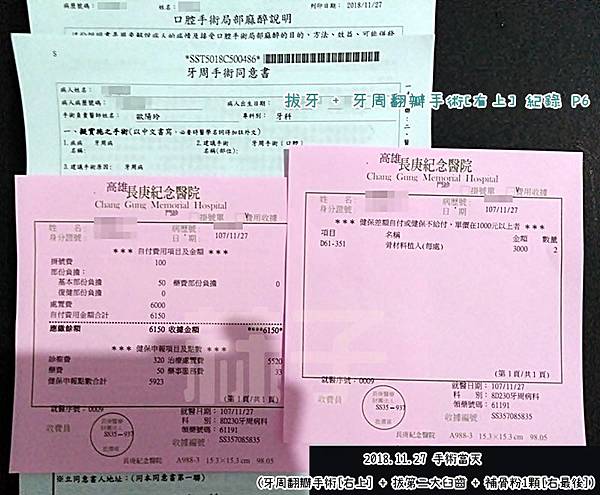 菻子a記事 牙周翻瓣手術理賠全紀錄 自己爭取保單理賠權益 保單孤兒 國泰人壽 S 菻子a專屬小角落ண 痞客邦