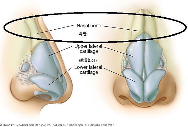 Nasal bone.jpg Nasal bone.jpg
