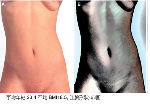 umbil4.jpg umbil4.jpg