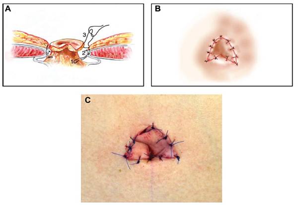 umbil8.jpg umbil8.jpg