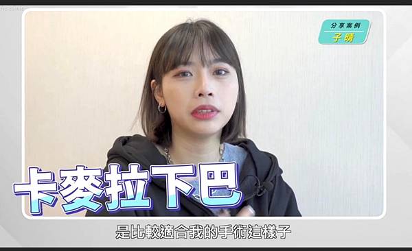 卡麥拉下巴- 個案心聲分享 卡麥拉下巴- 個案心聲分享