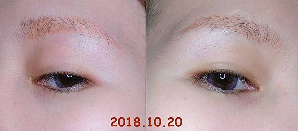 1020 1020