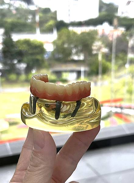 【牙醫告白】Allon4不要輕易做，因為會用掉一生只有一次的