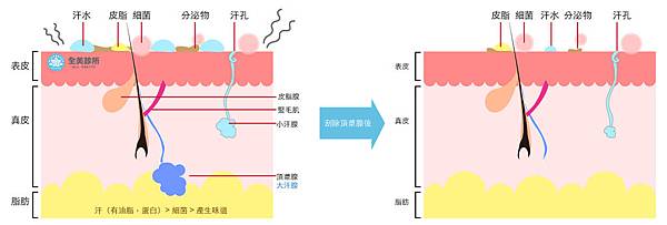 皮脂腺.jpg