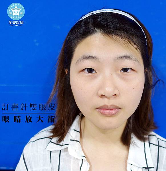 OPP-拷.jpg