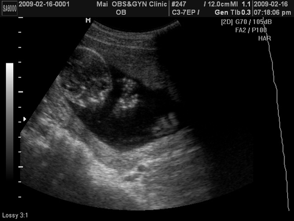 BABY2009-2-16_2.JPG