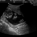 BABY2009-2-16_2.JPG