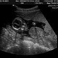 BABY2009-2-16_3.JPG