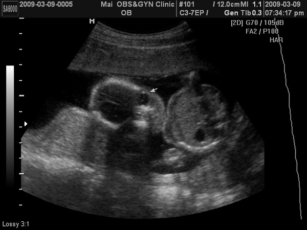 BABY2009-3-9_2.JPG