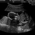 BABY2009-3-9_2.JPG